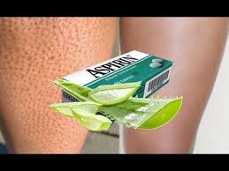 Action Rapide Pour Les Jambes Parfaites Avec Ces 2 Ingredients Youtube Epilation Jambe Poil Incarne Epilation Maison