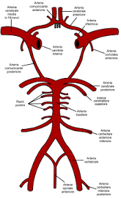 Con il termine aneurisma cerebrale si intende un rigonfiamento all'interno di un vaso sanguigno situato nel cervello.l'aneurisma cerebrale può rompersi, causando quindi gravi emorragie cerebrali. Aneurisma Cerebrale Wikipedia