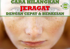 Produk anti jerawat berbentuk gel yang ringan ini mengandung 2% salicylic acid yang dapat melawan jerawat nah, itulah 4 produk perawatan wajah pria yang ampuh untuk menghilangkan jerawat. 7 Punca Jeragat Dan Cara Hilangkan Jeragat Dengan Cepat Lagi Berkesan Coach Bisnes Coach Detox Kurus Coach Penyusuan Susu Ibu Mentor Bisnes Pengedar Shaklee Pengedar Youth Pengedar Vivix 011 17547669