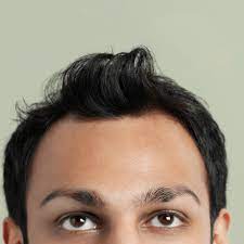 Can Wearing Hats Cause Hair Loss Skalp Hair Loss Blog