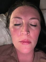 Hello everyone, I would appreciate some advice if possible. I've been  experiencing heart palpitations and arrhythmia since I started taking  levothyroxine. At first, I was