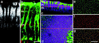 Müller glia, or müller cells, are glial cells found in the retina, which serve as support cells for the neurons of the retina as all glial cells do. Muller Cells Are Living Optical Fibers In The Vertebrate Retina Pnas