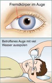 Fremdkorpergefuhl Im Auge Ursachen Behandlung Hilfe Medlexi De
