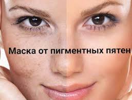 как избавиться от белых пятен на лице в домашних условиях Maska Ot Pigmentnyh Pyaten Chistoe Lico Lico Lechenie Pryshej