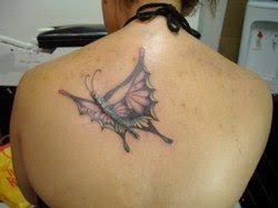 Keloids are a type of raised scar that occurs when the skin has healed after a wound. Pin On Hair And Makeup