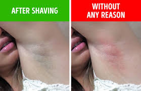 Skin problems such as impetigo or rashes like poison ivy can. 6 Armpit Signals That Can Indicate Health Issues