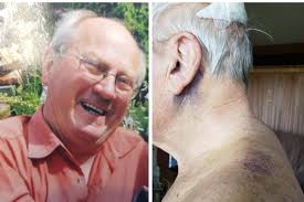 Devastated family tell of heartbreak as Leeds pensioner left 'black and  blue' after Morley crash