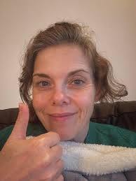 So I'm laying in bed and hubby is next to me sitting up. We looked at my  scar and, well… here it is. I would definitely be farther along had fibro  not