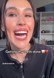 Alex Scott Giving Straight Teeth