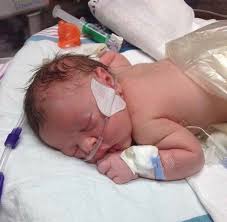 The Doctor Said It So Nonchalantly Your Baby Has This I Looked At My Husband What S That Mean We Were Not Ready For This Diagnosis The Tears Poured Out How Is This