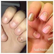 Great for those looking to add length and strength to their nails, acrylics can also create a larger, more evenly shaped canvas for. Nail Biting Nail Matsuri