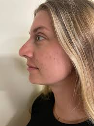 Hi everyone. I have been dreaming of plastic surgery