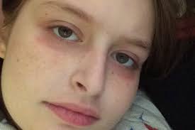 Fundraiser by Anna McKay : Kaya's medical expenses