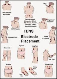 Perpendicular magnetic recording, a technology for data recording on hard disk. 23 Pmr Ideas Polymyalgia Rheumatica Fibromyalgia Temporal Arteritis