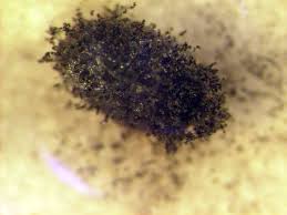 A investigação de casos suspeitos da mucormicose, conhecida como fungo preto. Http Www Biologico Agricultura Sp Gov Br Uploads Docs Bio V73 1 Kruppa Pdf