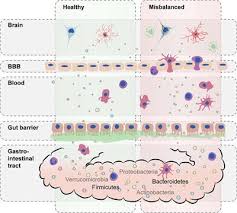 Anuar hong & ong is a lawyer firm located in puchong, selangor with 1 practicing lawyer. Frontiers Contribution Of Gut Microbiota To Immunological Changes In Alzheimer S Disease Immunology