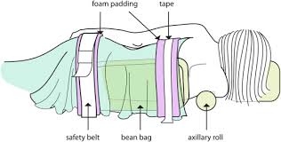 The exact position is indicated by which surface of the body is closest to the flat surface: Basic Shoulder Arthroscopy Lateral Decubitus Patient Positioning Sciencedirect