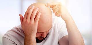 Why Is My Hair Falling Out In Dubai and How to Cure?