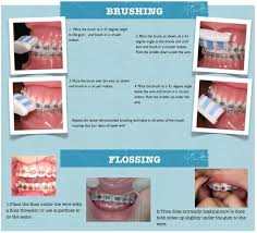 Dentists specialize here in bridges, crowns, dentures, root canal treatment, aesthetic and pediatric dentistry. Orthodontics Gc Dental Clinic