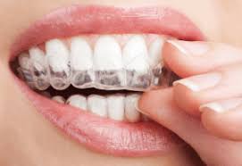 They are prone to warping or breaking, so they may need replacing to be replaced relatively frequently. Houston Dental Retainers Replacements Advance Orthodontics
