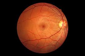 Maybe you would like to learn more about one of these? Associated Retina Consultants What Causes Retinal Tears And Detachments Phoenix Associated Retina Consultants
