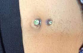 Piercing Bumps The Complete Infection And Treatment Guide 2020