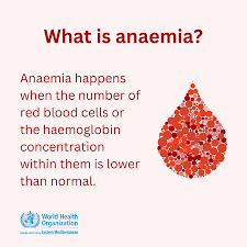 Image result for Anemia