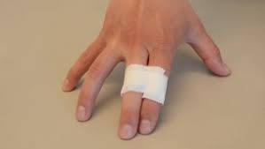 Brudd i kragebeinet oppstår gjerne hos unge og middelaldrende etter fall. Forstuing Av Finger