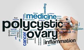 Pcos is one of the most common causes of female infertility, affecting 6% to 12% (as many as 5 million) of us women of reproductive age. Polycystic Ovarian Syndrome Pcos Renee Cotter Md Gynecologists