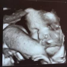 Use our baby weight chart to find out where your baby falls on the growth charts. How Much Did Your Baby Weigh At 34 Weeks Glow Community