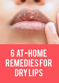At Home Remedies For Dry Lips Remedies For Chapped Lips Dry Lips Remedy Dry Lips Healing Dry Lips