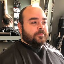 Buckhead Hair Loss Solutions