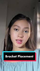 #stitch with @cotton bracket placement 🦷 #denteetha