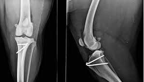 Har du akuta besvär ska du kontakta din egen doktor, närmaste. Orthopadische Chirurgie Tierklinik St Polten