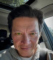 They forgot to ask me to take out my contacts before using iodine drops at  the eye doctor this morning so now my contacts are… yellow!