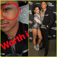 Maybe you would like to learn more about one of these? Tinashe Gave Brandon Armstrong A Black Eye After Their Stunning Argentine Tango On Dwts Brandon Armstrong Dancing With The Stars Tinashe Just Jared Jr