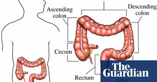The colon (large intestine) is the distal part of the gastrointestinal tract, extending from the cecum to the anal canal. Mapping The Body The Sigmoid Colon Life And Style The Guardian