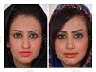 Image result for ‫هزینه عمل دکتر دستغیب جراح پلاستیک شیراز‬‎
