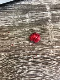 In this guide, we will cover the following topics you can find berry bushes growing in grassy areas and forest areas where you would find mushrooms and potatoes growing. What Is This Small Red Berry That Grows On A Vine On The Ground In My Grass The Little Red Bits On It Fall Off If I Touch It Found In Maryland