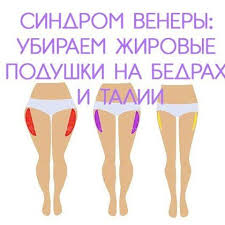 как похудеть в бедрах и попе в домашних условиях Sindrom Venery Ubiraem Zhirovye Podushki Na Bedrah I Talii Programma Trenirovok Fitnes Memy Uprazhneniya