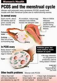What Happens When We Have Pcos This Does Pcos Polycystic Ovary Syndrome Pcos Polycystic Ovaries