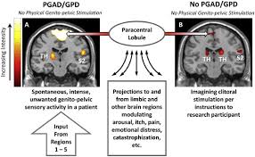 This is a free resource for the scientific community that is compiled by addgene. International Society For The Study Of Women S Sexual Health Isswsh Review Of Epidemiology And Pathophysiology And A Consensus Nomenclature And Process Of Care For The Management Of Persistent Genital Arousal Disorder Genito Pelvic Dysesthesia