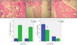Replacement and equivalent for 2sd965. Poly Lactic Co Glycolic Acid Plga Tio2 Nanotube Bioactive Composite As A Novel Scaffold For Bone Tissue Engineering In Vitro And In Vivo Studies Sciencedirect