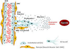 mesothelioma symptoms of peritoneal mesothelioma may include swelling, pain due to fluid in the abdomen cavity, sudden weight loss, and a mass in the abdomen. Frontiers Antiangiogeneic Strategies In Mesothelioma Oncology