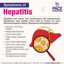 Image result for hepatitis symptoms
