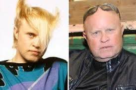 Image result for HAIR Score