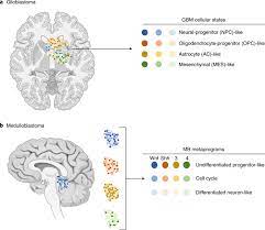 The rise is of importance for clinical resources and brain tumour aetiology. Deciphering Brain Tumor Heterogeneity One Cell At A Time Nature Medicine