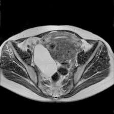 Mrt Becken Radtop De Praxis Fur Radiologie Neuroradiologie Dr Topcu Kollegen