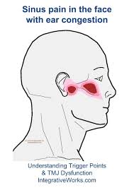 Pin On Sinus