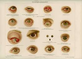1894 Antique Eye Disease Diseases Antique Medical Human Anatomy Color Lithograph Print